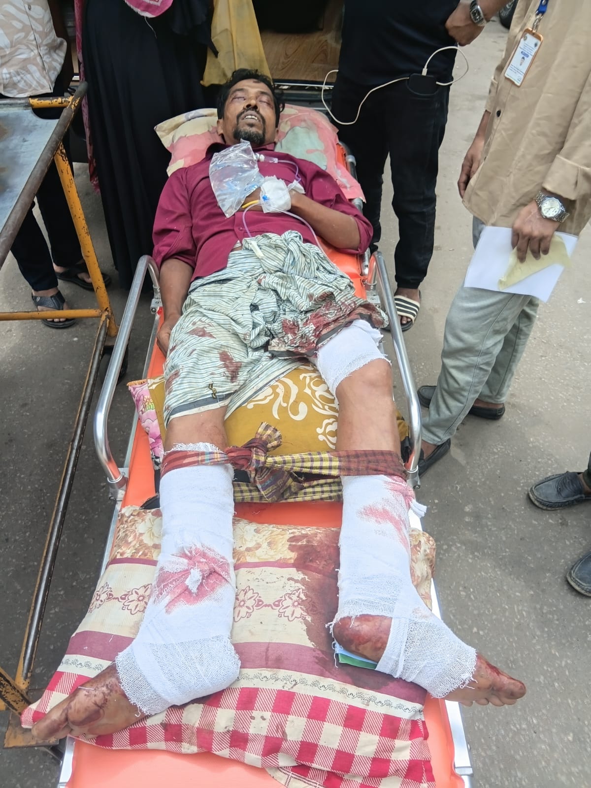 শিবচর উপজেলার ভান্ডারিকান্দি ইউনিয়ন পরিষদের সদস্য মোঃ জুনায়েদ চোকদার এর উপর হামলা